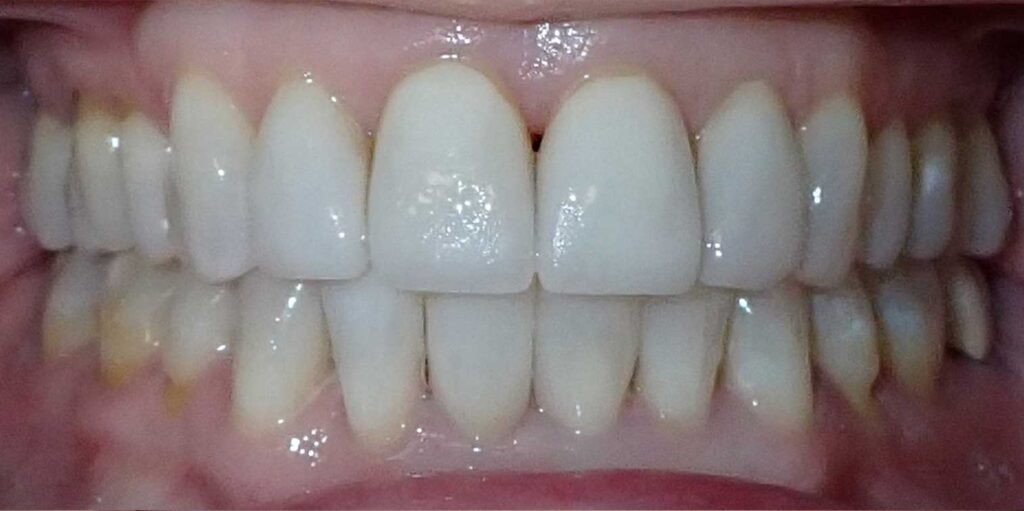After