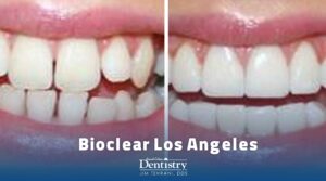 Bioclear Los Angeles