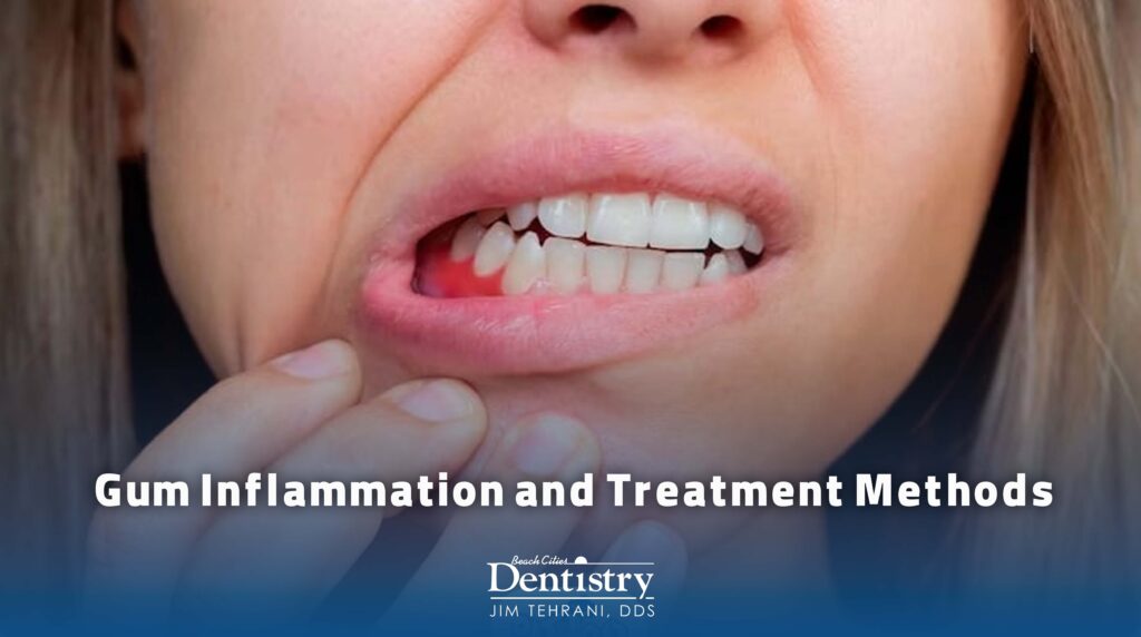 Gum Inflammation