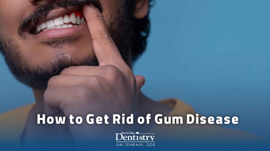 How to Get Rid of Gum Disease 