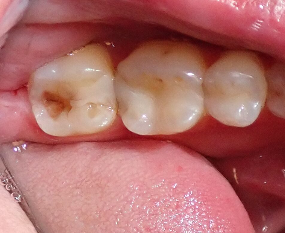 Before