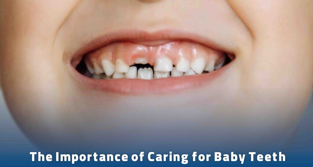 The Importance of Caring for Baby Teeth